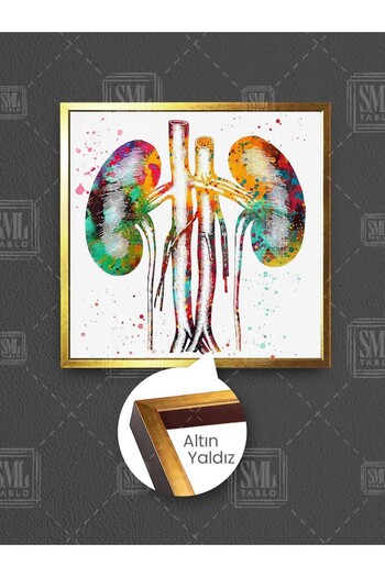 SML TABLO Urologist Urology Doctor Examination Room Decor Colorful Illustration Framed Square Canvas Painting