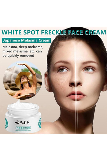 MACON Japanese Melasma Cream Anti Ageing Face Moisturizing Skin Care Cream for All Type Skin