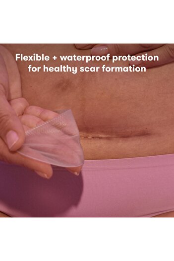 Frida Mom C-Section Silicone Scar Strips, Reusable Medical Grade Patches with Case