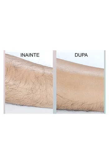 NEO Epilator cu Cristale, pentru Epilarea de Lunga Durata, Roz, Neo™