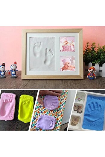 OEM Hand or foot cast