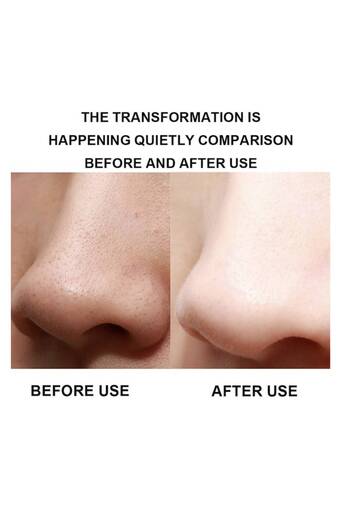 OEM Ultrasonic facial cleansing device, skin lifting, skin scrubber, blackhead removal