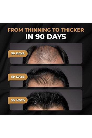 SPARTAN ™ Root Activator Shampoo for Men - Hair Growth Shampoo for Hair Loss and Thinning Hair