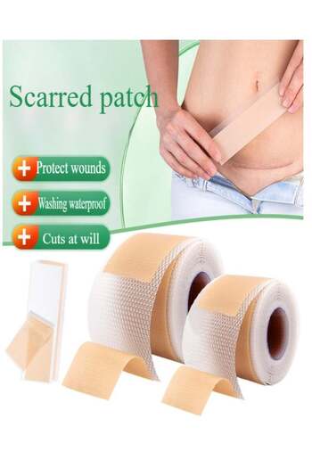 Healife Silicone Scar Tape – Medical Grade, Waterproof Scar & Stretch Mark Removal, 4cm x 1.5m