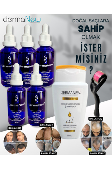 5x50ml Hair Rejuvenating Serum - Anti-Hair Loss Shampoo with Roller Gift