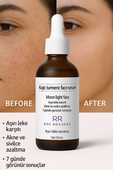 Kojic Acid + Turmeric Extract Anti-Blemish Serum |   Skin Tone Equalizer