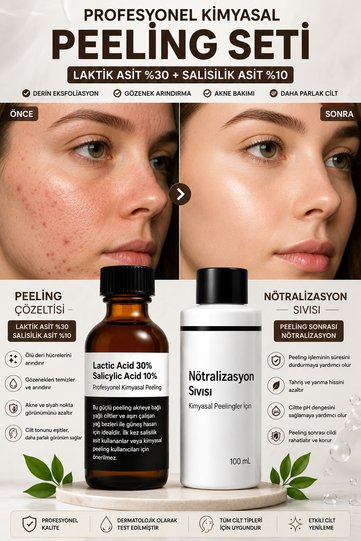 Deep Exfoliation and Pore Refining Professional Peeling Set – Lactic Acid 30% + Salicylic Acid 10% and Post-Peeling Neutralizing Solution