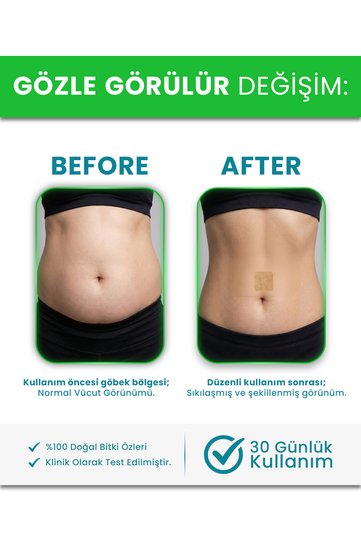 Slim Band