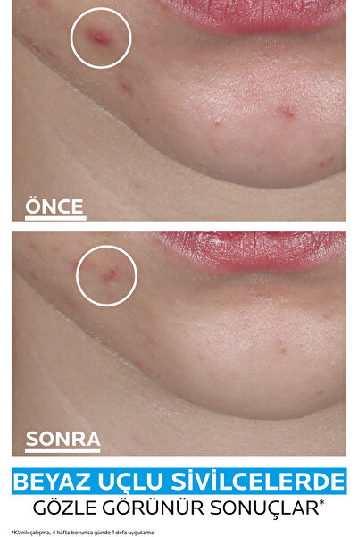 La Roche Posay Effaclar Duo+M Patch Sivilce Bandı 22 ADET