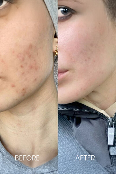 FaceLab Aydınlatıcı Leke Karşıtı Serum – Cilt Tonu Eşitleyici & Aydınlatıcı Bakım