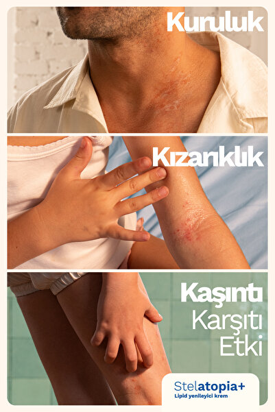 Mustela Organik Sertifikalı Stelatopia+ Çok Kuru Atopik Cilt Krem Bebek Çocuk Yetişkin 150ml