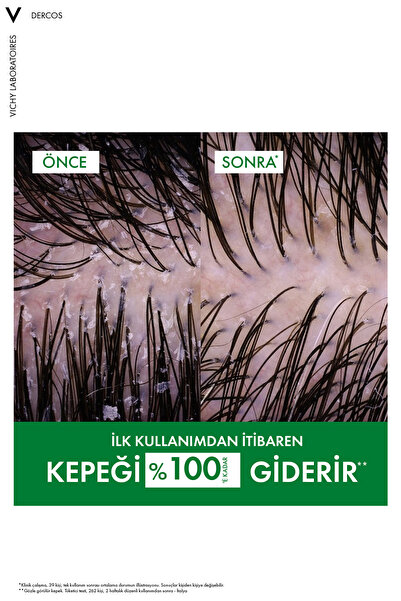 Vichy Dercos Anti Dandruff Kuru Saçlar İçin Geliştirilmiş Kepeklenmeye Karşı Etkili Bakım Şampuanı 390 ml