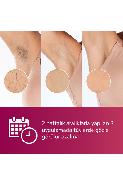 Philips Lumea 7000 Serisi BRI920/00 IPL Tüy Alma,Tüy Kısaltıcı,Vücut için 1 Başlık, Çanta