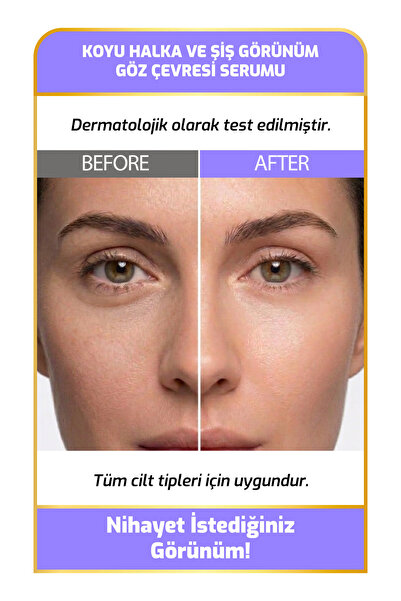 New Essentials Göz Çevresi Aydınlık Görünüm Destekleyici Bakım Serumu (Peptide Complex + Allantoin)