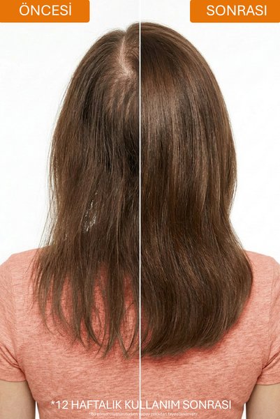 ASHLEY JOY Dökülme Karşıtı Keratin Ve Kafein Içeren Sülfatsız Güçlendirici Şampuan 400 ml X3 Set