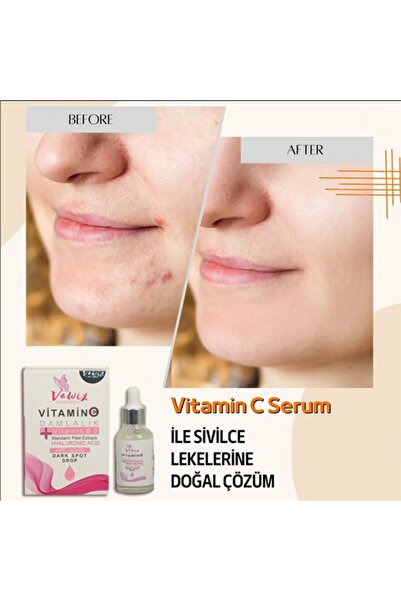 Vawix سيروم فيتامين سي مضاد للبقع الداكنة والتجاعيد