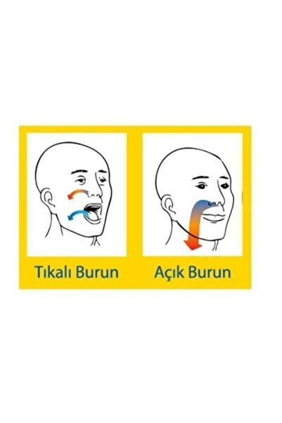 Genel Markalar Nozovent Horlama Önleyici Burun Açıcı Rahat Nefes Aparatı-orta...
