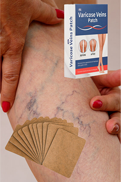 xolo Varis Isı Bandı 40 Adet Mentol Etkili Bacak Bölgesi Hafif Orta Yoğun Kullanım XLM552552