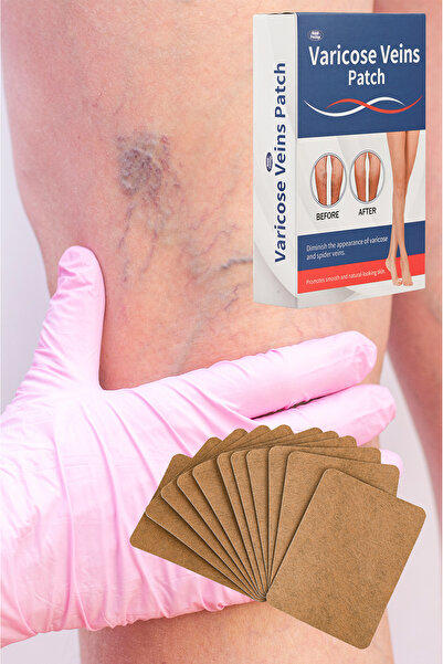 xolo Varis Isı Bandı 40 Adet Mentol Etkili Bacak Bölgesi Hafif Orta Yoğun Kul...