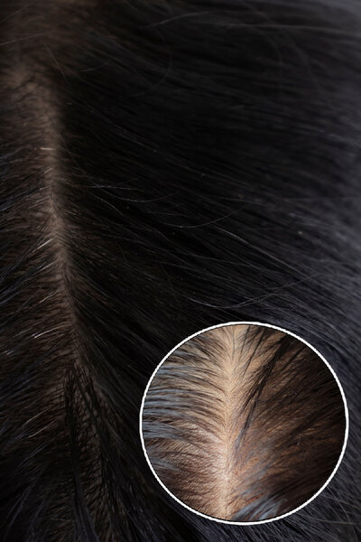 Duru Misket Limonu&Kolajen Yağlı Saçlar için Şampuan 3x500 ml