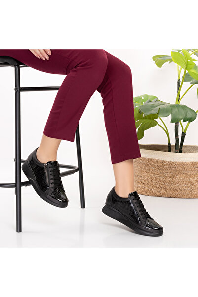 Mira Terlik أحذية Mira الجلدية النسائية لتقويم العظام مناسبة للكعب ونتوء العظ...