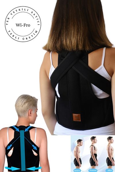 Wi Fro Upright Posture Corset with Underwire Unisex Anti-Hunchback Corset Medical New Design