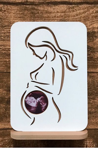 UTKU TASARIM Angel Ultrasound Image - My First Photo Album Picture Frame