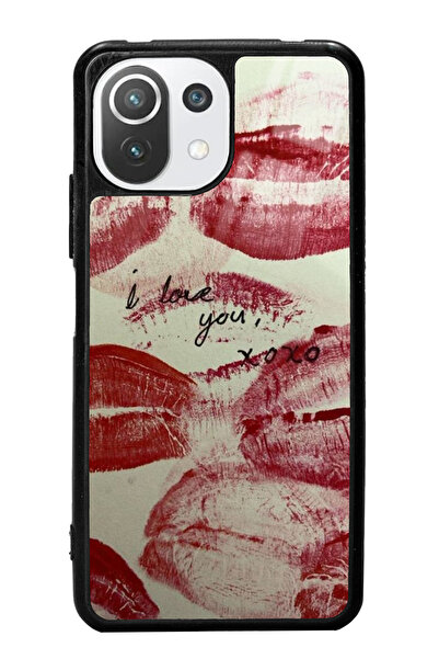 Spoyi Xiaomi Mi 11 Lite I Love You Tasarımlı Glossy Telefon Kılıfı