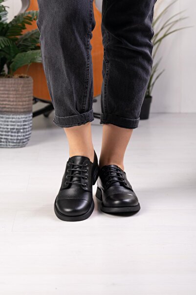 ALBİNİ HAKİKİ DERİ KADIN GÜNLÜK AYAKKABI 10116223K