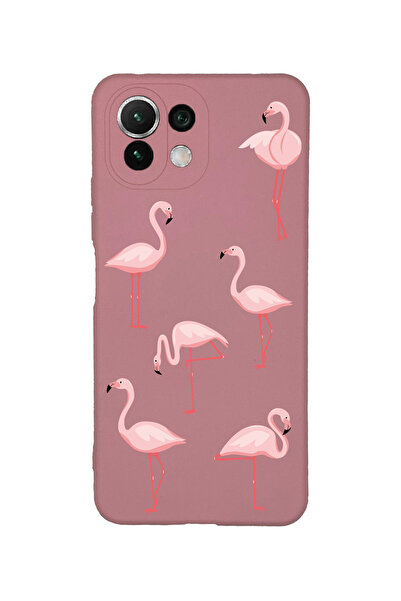 Merwish Xiaomi Mi 11 Lite Uyumlu Flamingo Göz Desenli İçi Kadife Lansman Sili...