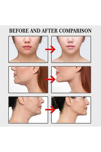 Medlight Face Lift Tape - Wrinkle Prevention Tape