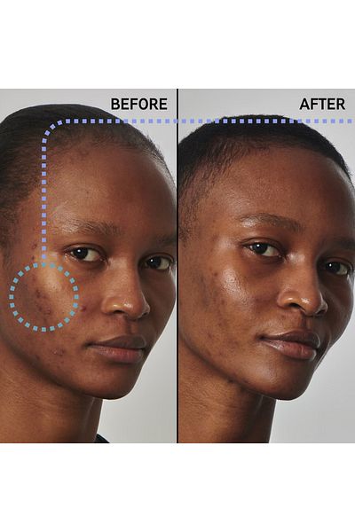 THE INKEY LIST Balancing -Pore Firming Face Serum for Oily Skin 30 ml KoÇak446