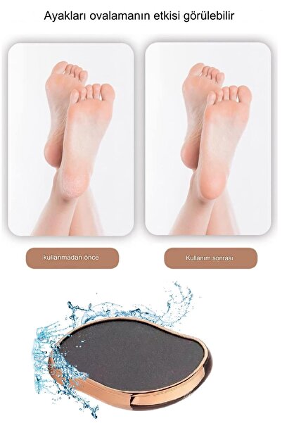 Uniquem Ayak Topuk Kristal Törpüsü Ayak Nasır Sökücü Pedikür Abs Için Ölü Sert Cilt Eseri Peeling Aleti