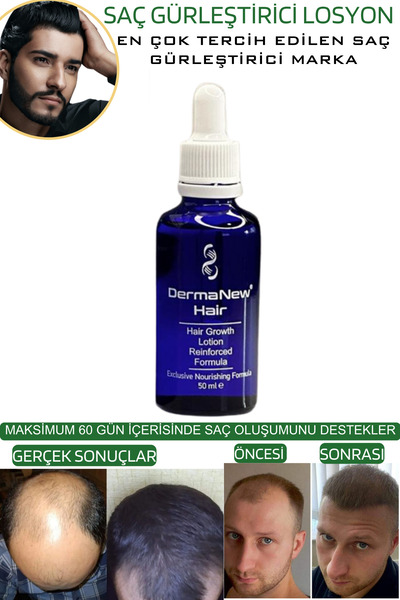 dermanew hair sac serumu sac bakim yagi3 Adet Serum + Roller + Şampuan