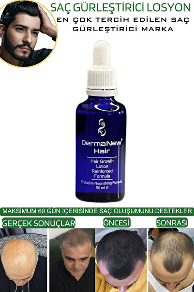 dermanew hair sac serumu sac bakim yagi3 Adet Serum + Roller + Şampuan