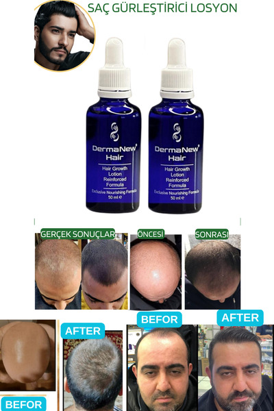 dermanew hair sac serumu  sac bakim yagi / 2 Adet Serum