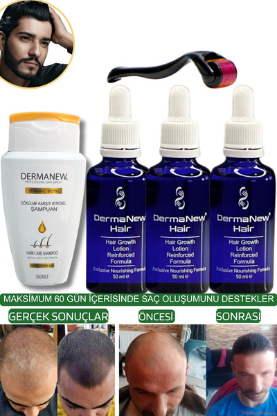 dermanew hair sac serumu sac bakim yagi3 Adet Serum + Roller + Şampuan