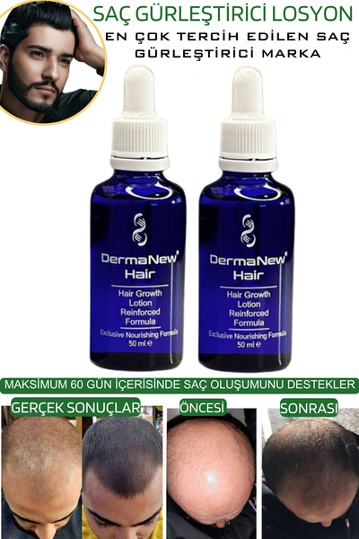 dermanew hair sac serumu  sac bakim yagi / 2 Adet Serum
