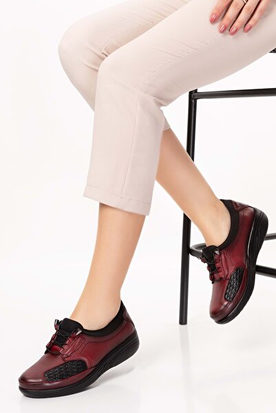 Gondol Hakiki Deri Kadın Kemik Çıkıntısına Özel Ayakkabı At.4204