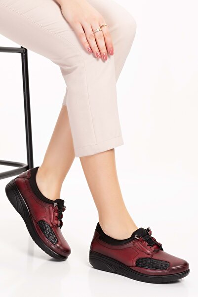 Gondol Hakiki Deri Kadın Kemik Çıkıntısına Özel Ayakkabı At.4204