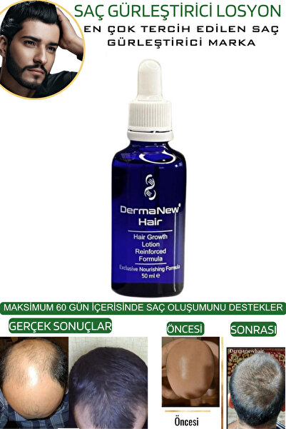 dermanew hair Sac Bakim - Saç Dökülmesi - Saç Uzatıcı - Sac Serumu 10 Adet Serum Roller Şampuan