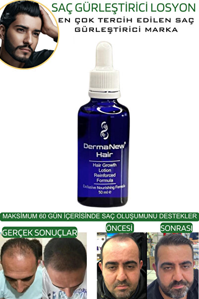 dermanew hair Sac Bakim - Saç Dökülmesi - Saç Uzatıcı - Sac Serumu 10 Adet Serum Roller Şampuan