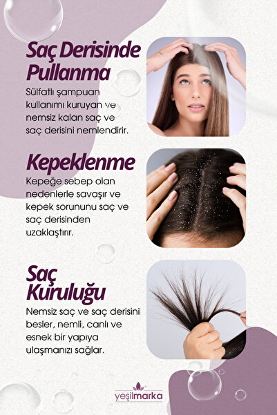 yeşilmarka Kepek Önleyici - Kepeğe Karşı Etkili - Kepekli Saçlar Için Kepek Karşıtı Doğal Şampuan 400 ml