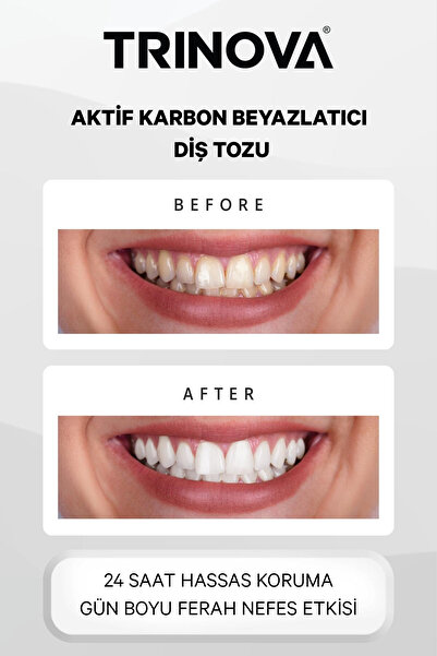 Trinova Diş Beyazlatıcı Toz Aktif Karbon Diş Temizleme Tozu