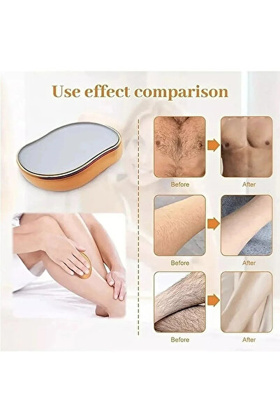 Seram Collection Crystal Eraser Epilasyon Aleti Tüy Silgisi Tüy Alıcı Fiziksel Kristal Epilatör