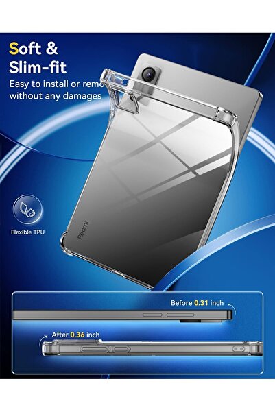 m.tk moveteck حافظة Xiaomi Redmi Pad Se مقاس 11 بوصة، مجموعة واقي شاشة شفاف مقاوم للصدمات