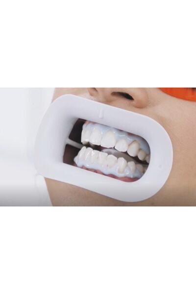 WHITEsmile Gri Ağız Ekartörü Dudak ve Yanak Genişletici Büyük Boy Sterilizasy...