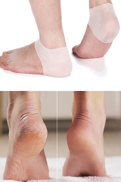 AfterTimes Nasır Çorabı Slikon Topuk Yastığı Koruma Yara Koruma