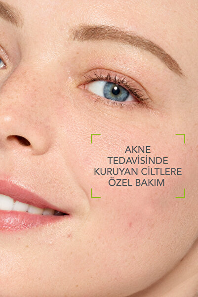 Bioderma Sebium İzokit Kurutucu Akne Tedavisi Destek Cilt Bakım Kiti(Temizleme Jeli-Bakım Kremi-Dudak Balm)
