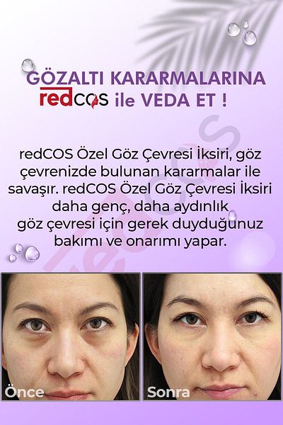 redCOS Anti-Under Eye Bruising, Swelling and Tired Appearance Brightening Serum Caffeine Hyaluronic Acid Niacinamide